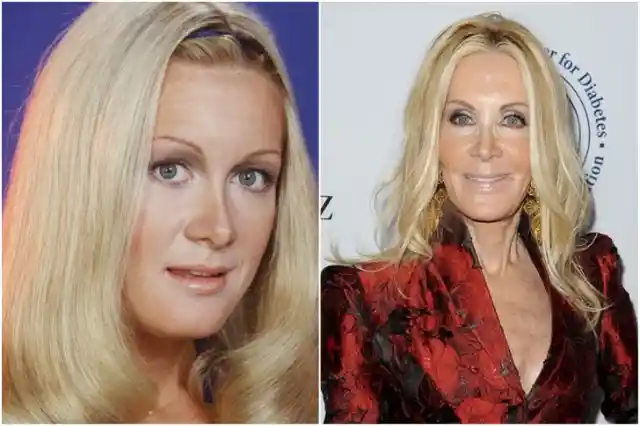 Joan Van Ark – Botched Plastic Surgery