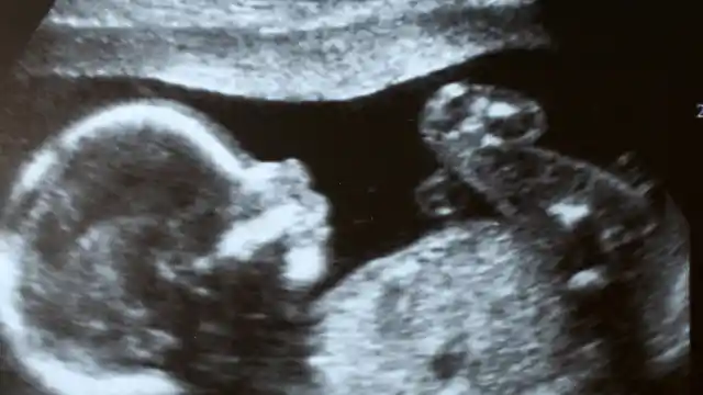Questioning The Ultrasound