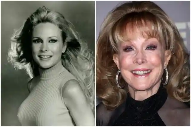 Barbara Eden – Cosmetic Surgery