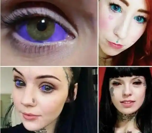 Scleral Tattoos