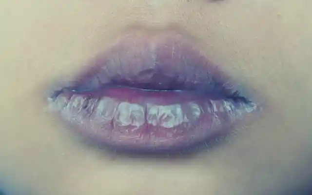 29. Blue-Tinged Lips
