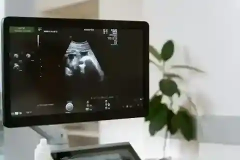 Ultrasonography