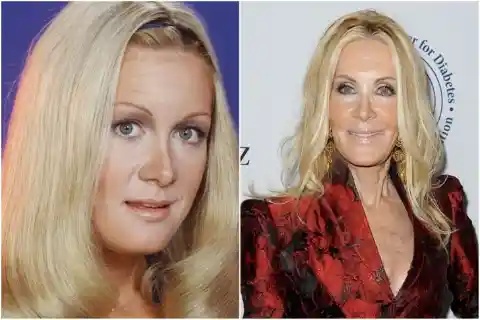 Joan Van Ark – Botched Plastic Surgery