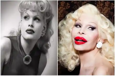 Amanda Lepore – Multiple Plastic Surgery