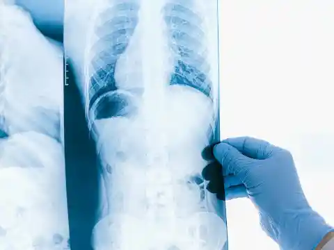 X-Ray