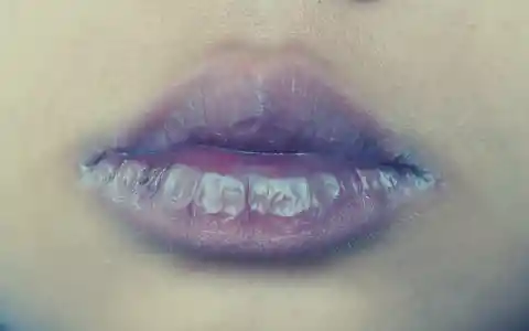 29. Blue-Tinged Lips