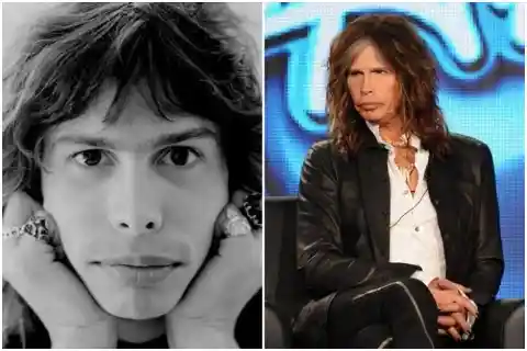 Steven Tyler – Plastic Surgery