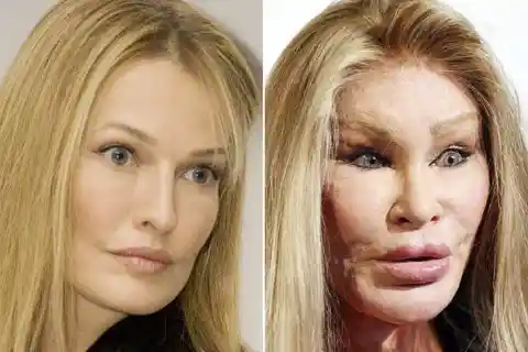 Jocelyn Wildenstein – Plastic Surgery Addiction